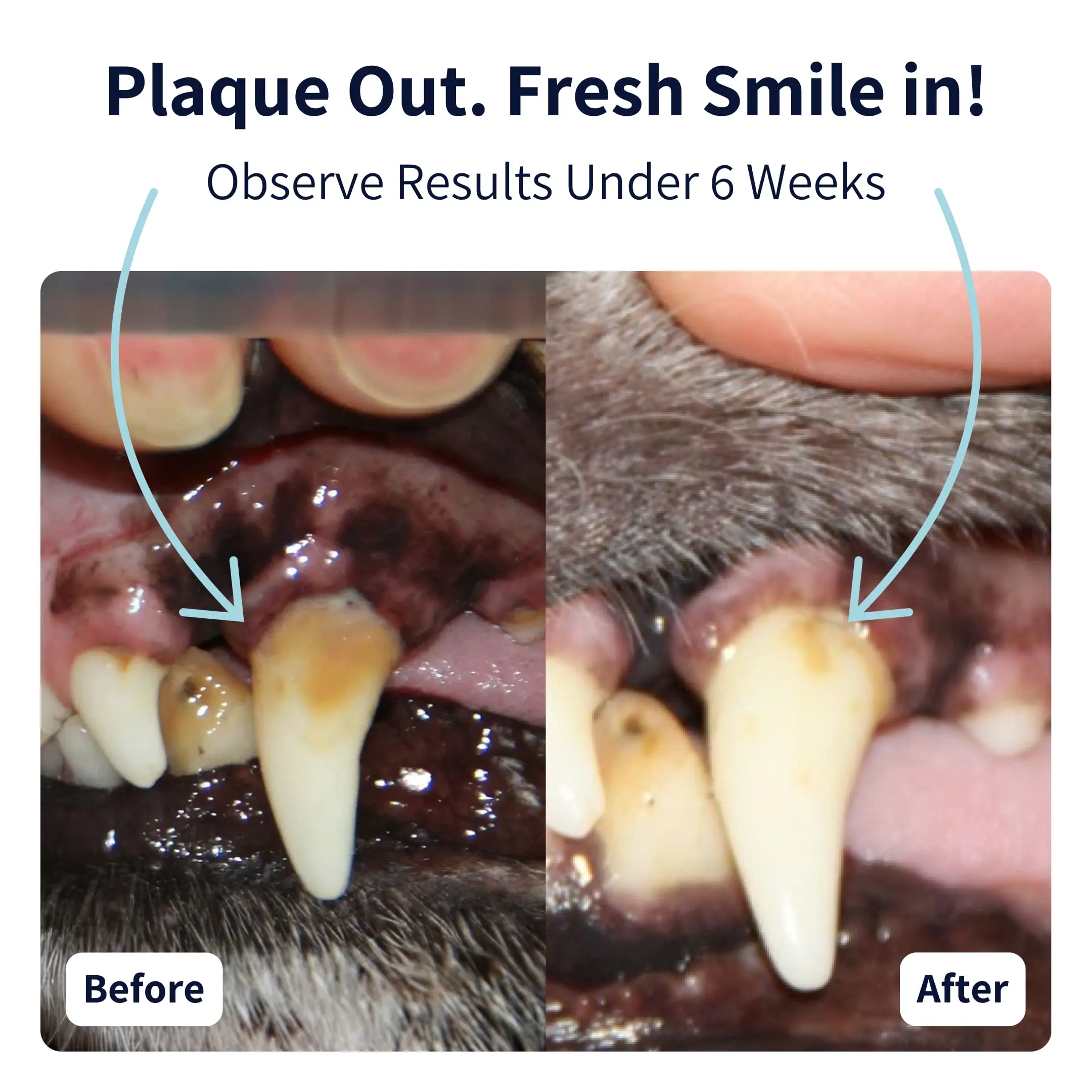 Dental-care-before-after